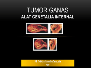 Tumor Ganas - icmzhe2subekti