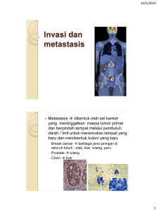 Invasi dan metastasis