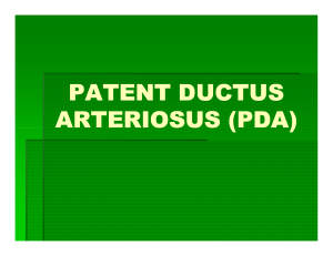 patent ductus arteriosus (pda)