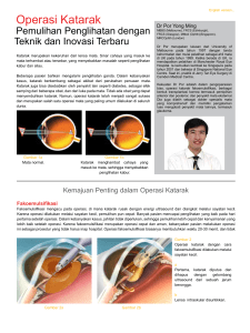 Operasi Katarak - Jerry Tan Eye Surgery