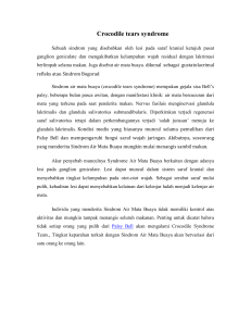 mata buaya, nervus 7, de quarvian syndrome