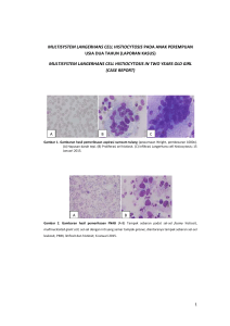 MULTISYSTEM LANGERHANS CELL HISTIOCYTOSIS PADA