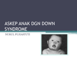 askep anak dgn down syndrome