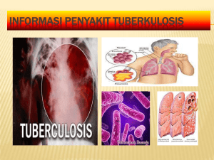 informasi penyakit tuberkulosis