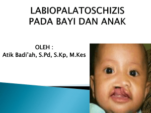 labiopalatoschizis pada bayi