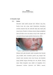 BAB II TINJAUAN PUSTAKA 2.1 Dermatitis Atopik 2.1.1 Definisi