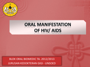 oral manifestation of aids