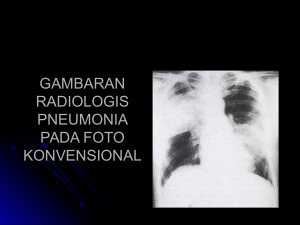 gambaran radiologis pneumonia pada foto konvensional