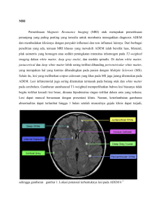 MRI Pemeriksaan Magnetic Resonance Imaging (MRI) otak