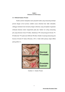 7 BAB 2 TINJAUAN PUSTAKA 2.1 Defenisi Kanker Prostat Kanker