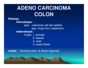 adeno carcinoma colon