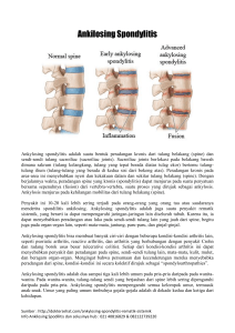 Ankilosing Spondylitis