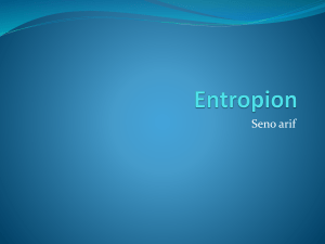 309689456-Entropion-dan-trikiasis-pptx