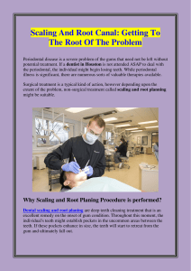 Scaling And Root Canal Getting To The Root Of The Problem