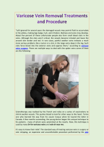 Varicose Vein Removal Treatments and Procedure