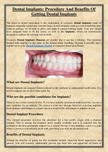 Dental Implants Procedure And Benefits Of Getting Dental Implants