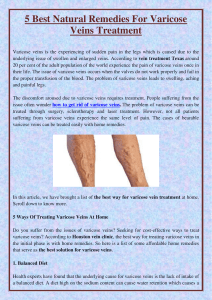 5 Best Natural Remedies For Varicose Veins Treatment