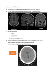 Cara membaca CT Scan kepala