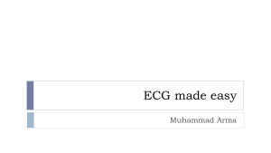 ecg made easy