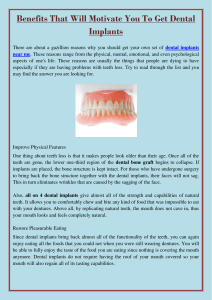 Benefits That Will Motivate You To Get Dental Implants