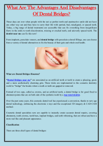 What Are The Advantages And Disadvantages Of Dental Bridges